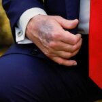 Bu ziyaret sırasında dikkat çekti! Amerika Birleşik Devletleri Başkanı Trump’ın çürüğü gündemdi: Bildirge Beyaz Saray’dan geldi